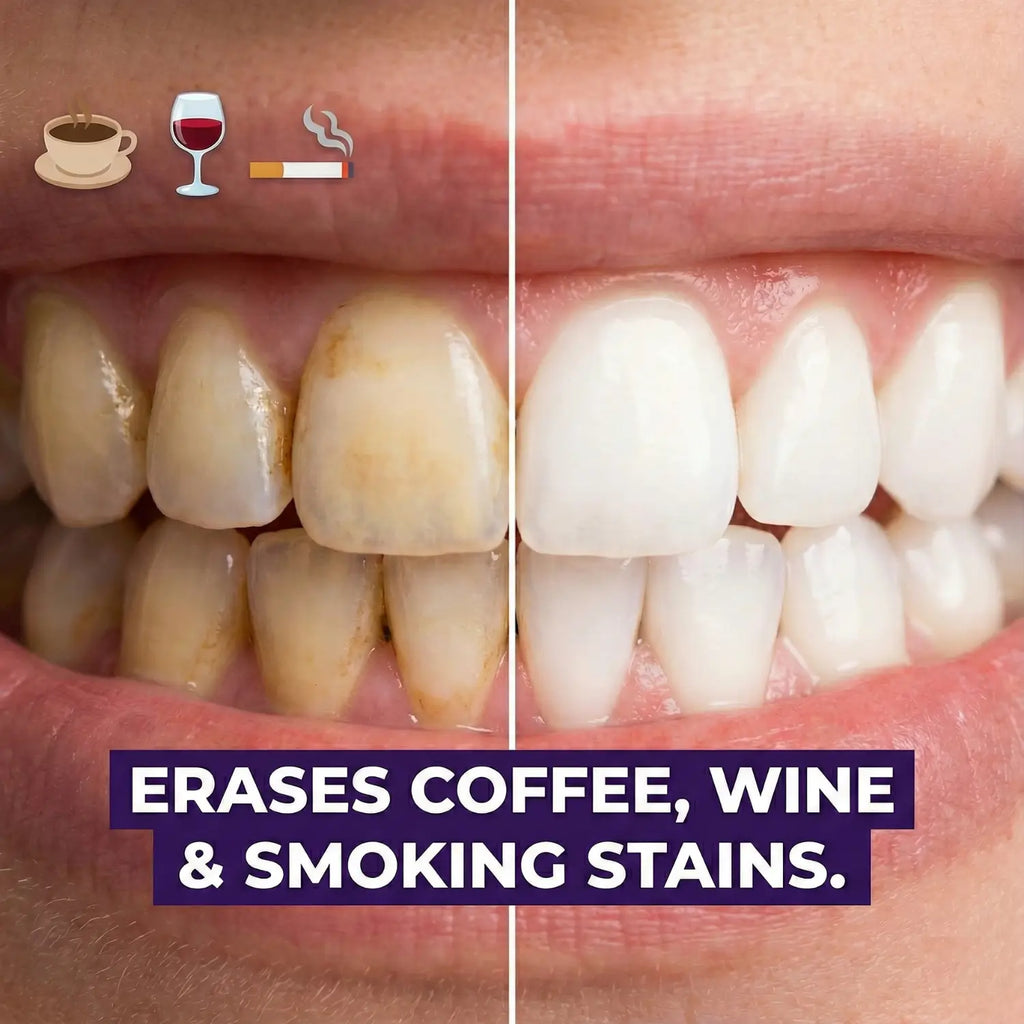 Purple Strips™ -  Sensitivity-Free Instant Whitening Strips