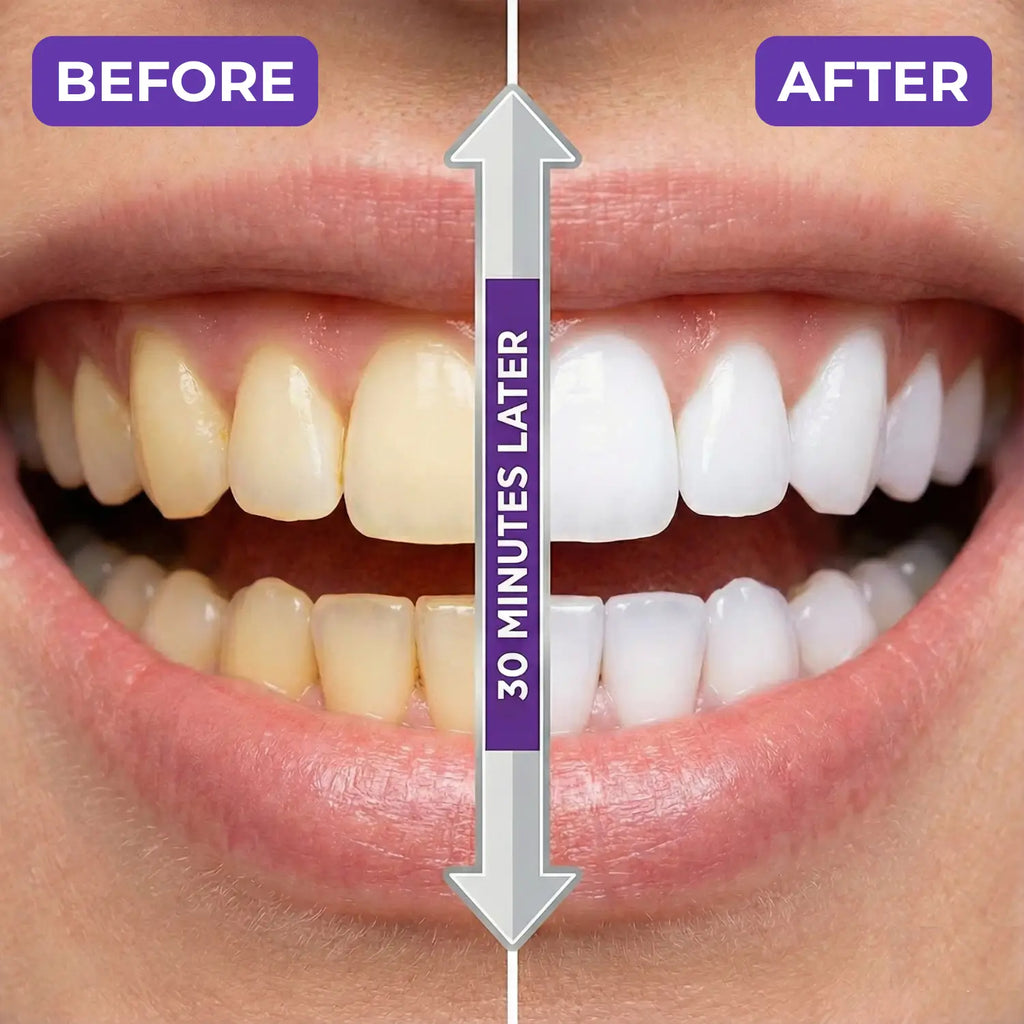 Purple Strips™ -  Sensitivity-Free Instant Whitening Strips